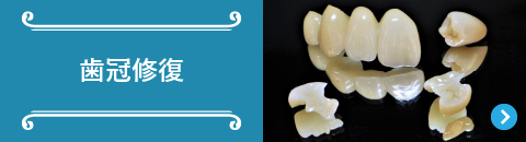 歯冠修復